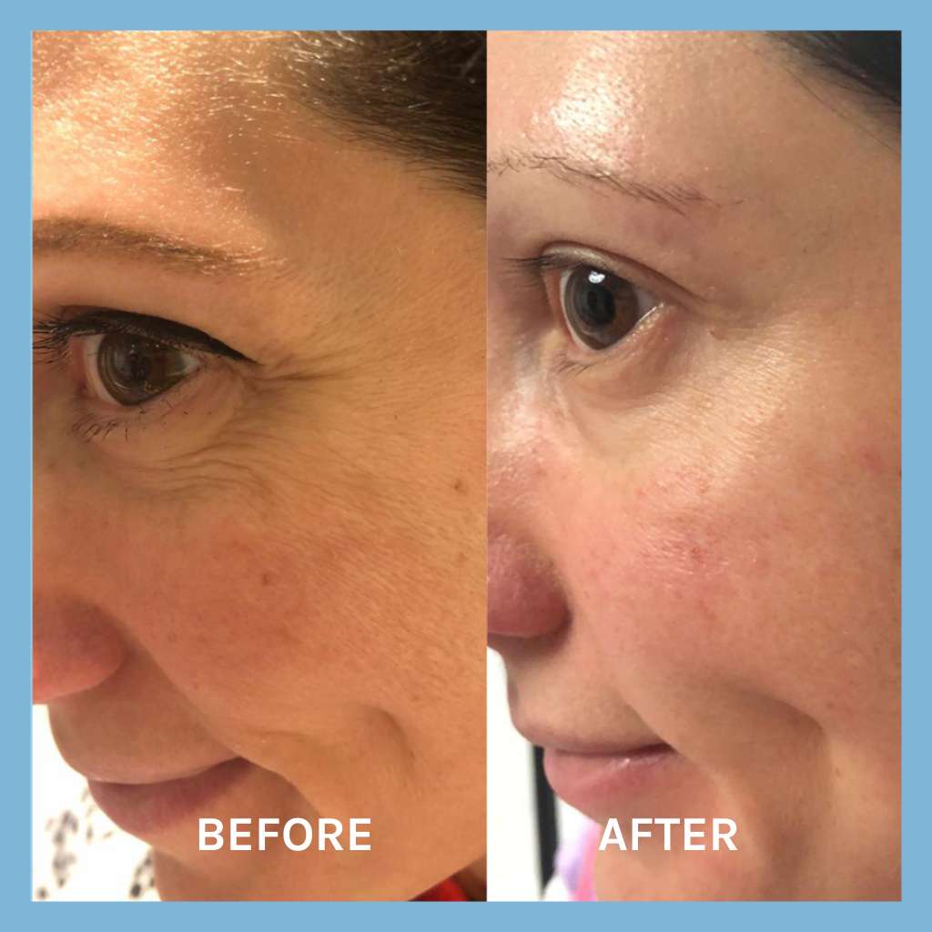 Age Defying Lifting Serum 30ml