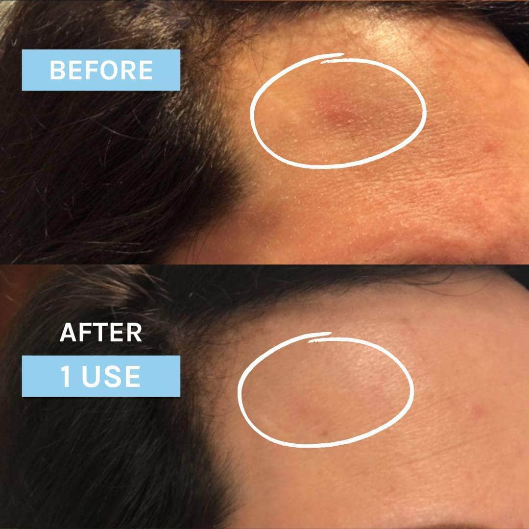 Blue Velvet Ceramide Serum 10ml