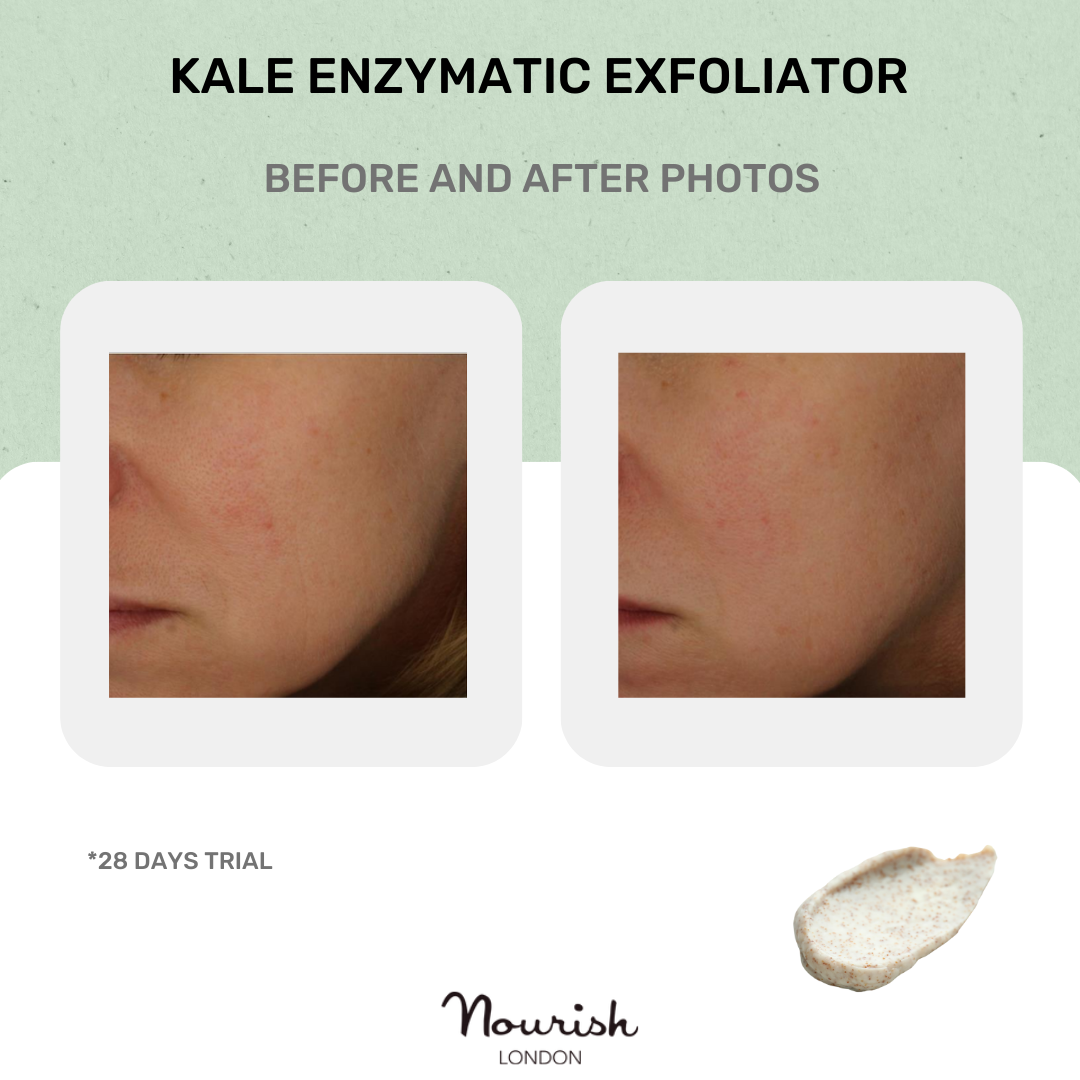 Kale Enzymatic Exfoliator 50ml