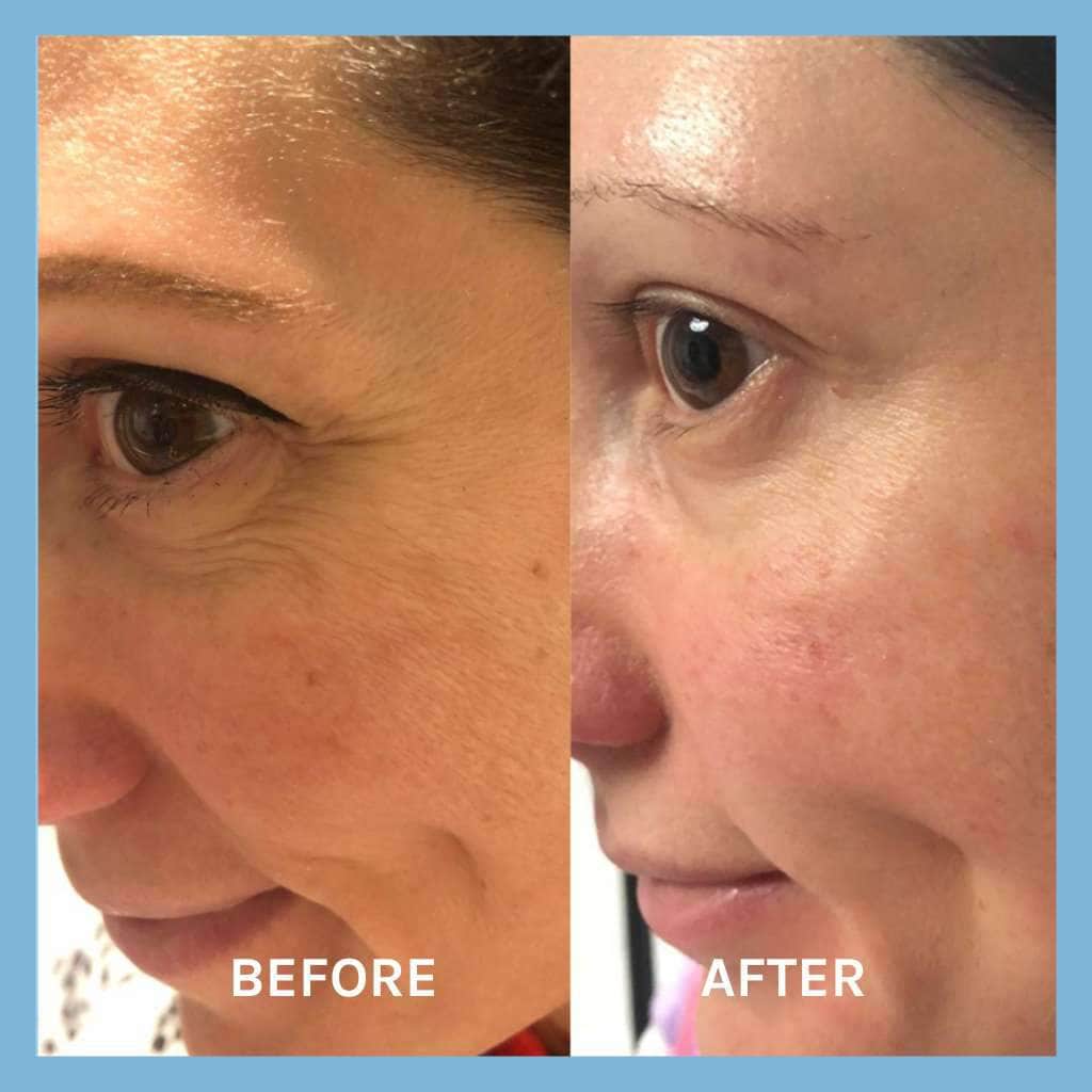 Age Defying Lifting Serum 30ml